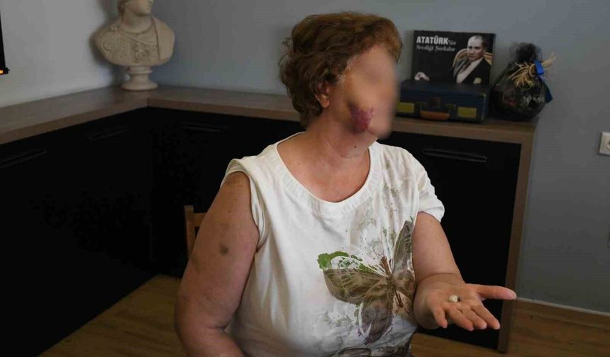 Kuşadası'nda ev kavgası kanlı bitti: Anne ve iki çocuğu bıçaklandı